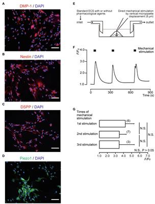 Mechanical Stimulation-Induced Calcium Signaling by Piezo1 Channel Activation in Human Odontoblast Reduces Dentin Mineralization